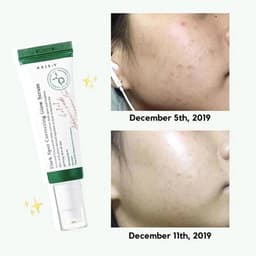 AXIS-Y Dark Spot Correcting Glow Serum (50ml) 6